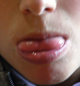 deglucion